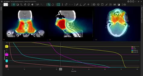 hermes medical solutions|hermes pet ct.